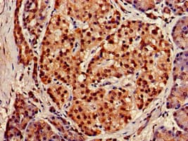 XPO1 / CRM1 Antibody