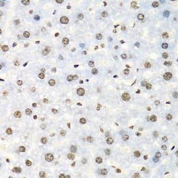 IGF2BP2 Antibody