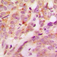 Polyclonal Rabbit anti-Human LAMA4 / Laminin Alpha 4 Antibody (Internal, IHC, IF, WB)