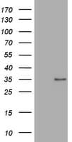 Monoclonal Mouse anti-Human ABCB1 / MDR1 / P Glycoprotein Antibody (clone OTI5F1, aa995-1280, WB)