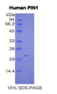 Human PIN1 Protein (Recombinant His)