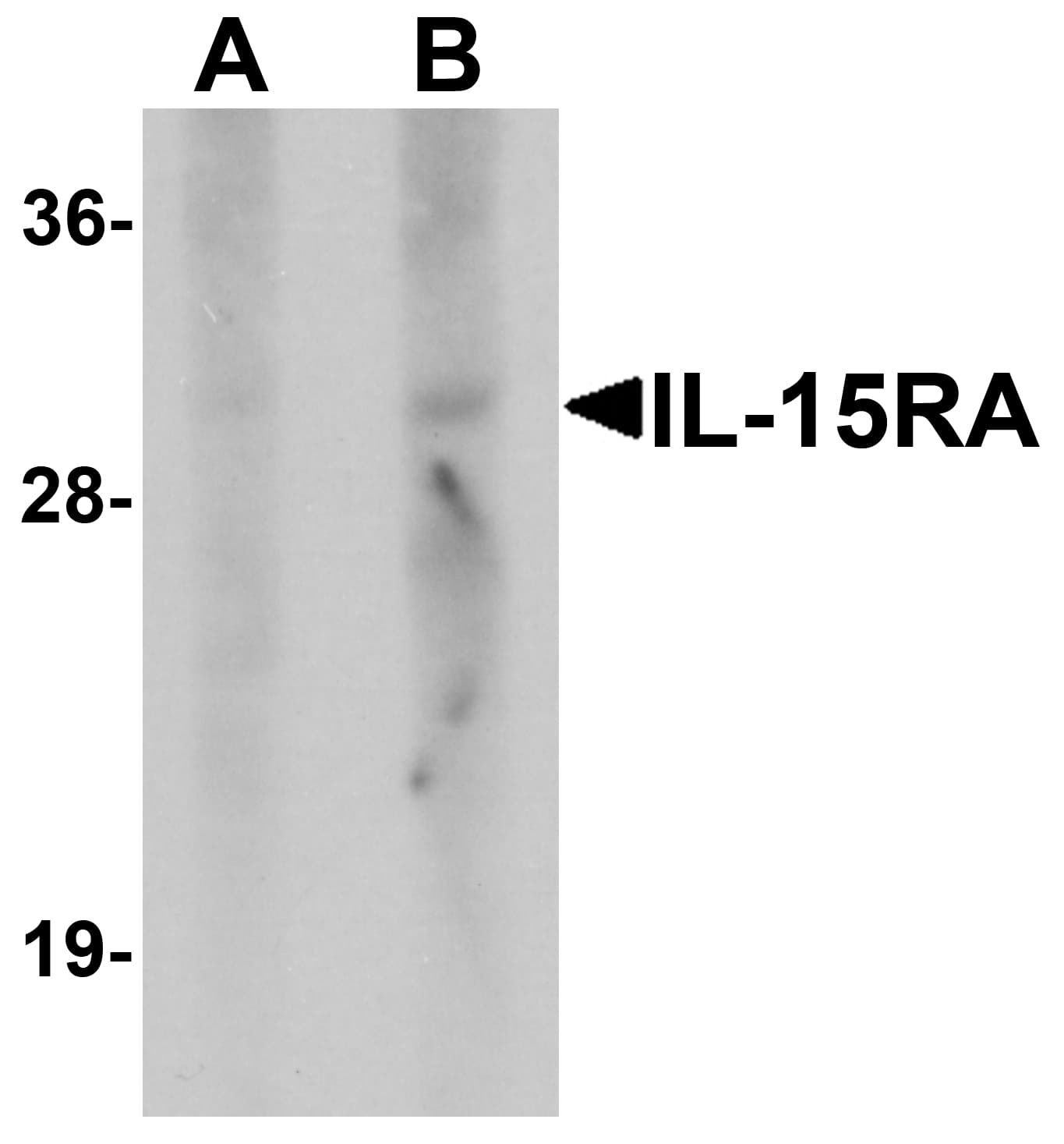 IL15RA Antibody