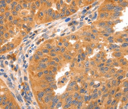 GRM8 / MGLUR8 Antibody
