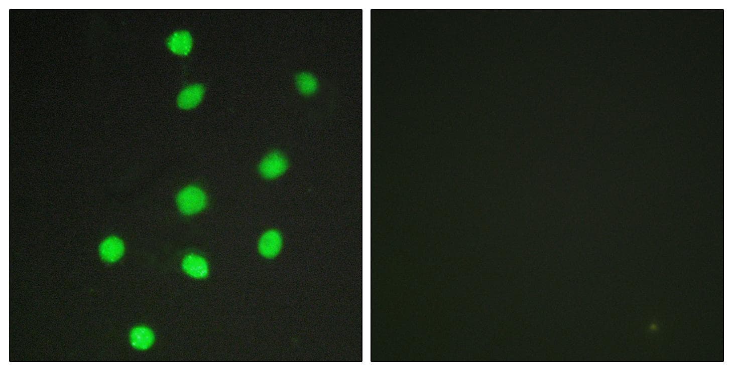Polyclonal Rabbit anti-Human GLI3 Antibody (IHC, IF)