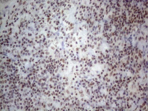 NR2C2 / TAK1 Antibody (aa1-241, clone OTI4B1)