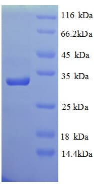 Human GRIN2A / NMDAR2A / NR2A Protein (Recombinant 6His, N-terminus)