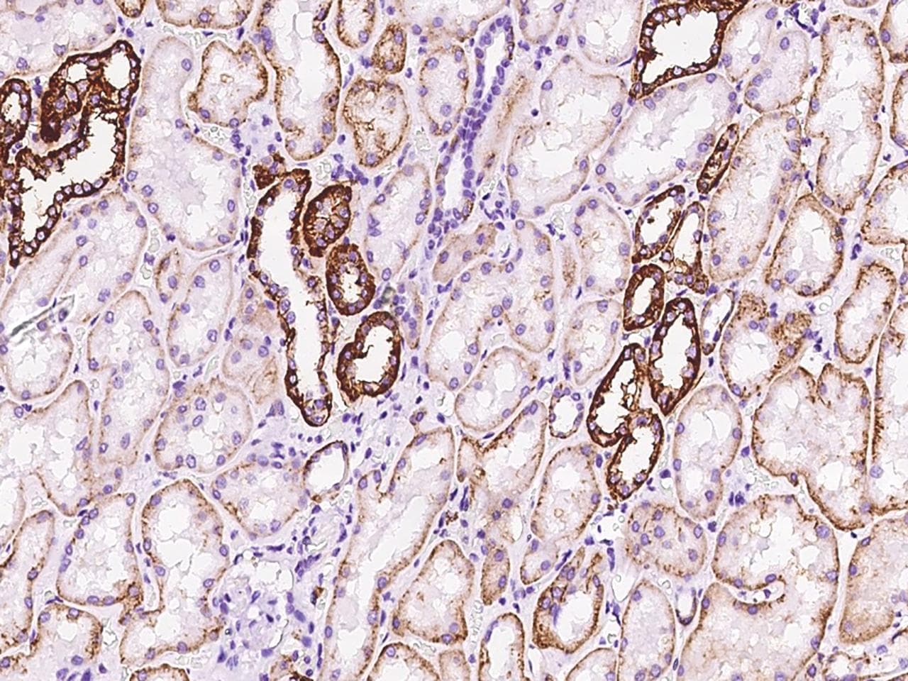 FXYD2 Antibody