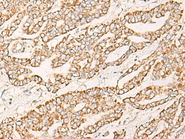 Polyclonal Rabbit anti-Human COX6C Antibody (IHC, WB)