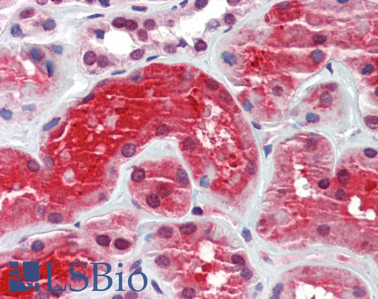 IHC-plus™ CRYM Antibody (clone 1G7)