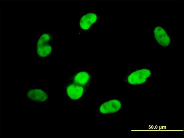 PathPlus™ Monoclonal Mouse anti-Human SOX9 Antibody (clone 3F11, IHC, IF, WB)