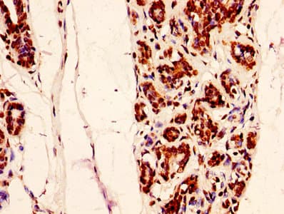 HIST1H2AI Antibody
