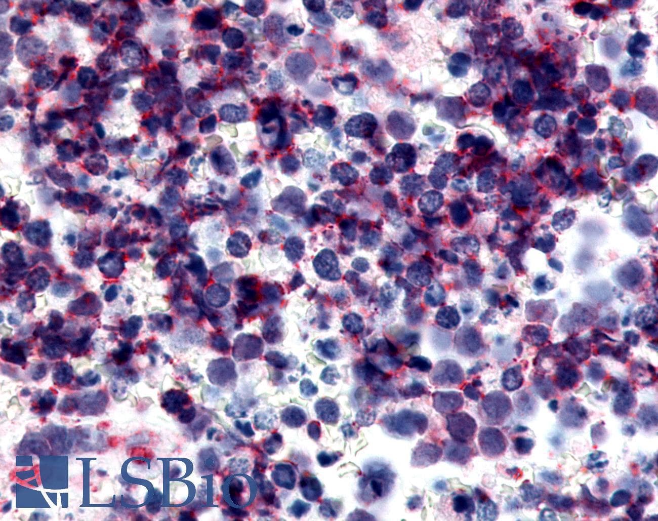 PathPlus™ Polyclonal Rabbit anti-Human P2RY12 / P2Y12 Antibody (N-Terminus, IHC)