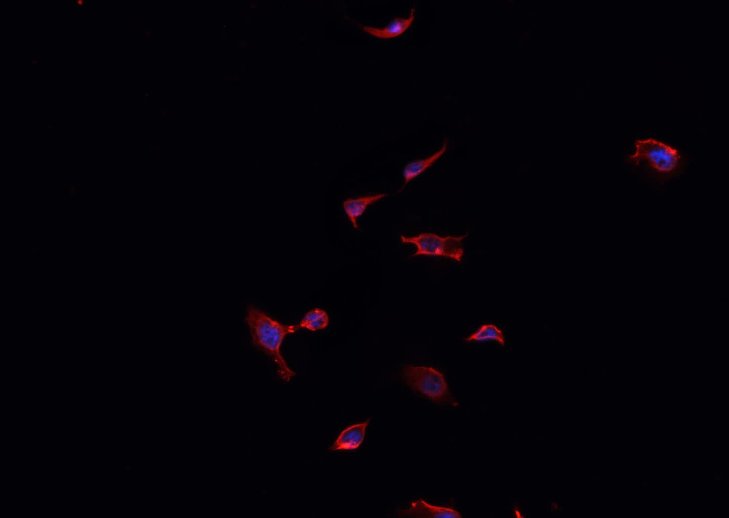 FAP Alpha Antibody