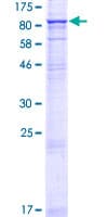 Human STRA6 Protein (Recombinant GST)