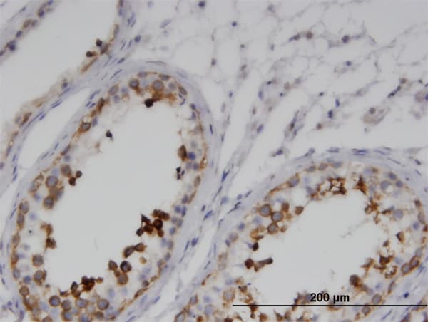 Monoclonal Mouse anti-Human GKAP1 Antibody (clone 1B9, IHC, WB)