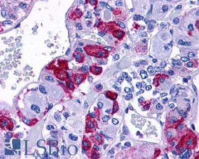 IHC-plus™ ADCYAP1R1 / PAC1 Receptor Antibody (N-Terminus)