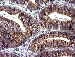 Monoclonal Mouse anti-Human CHAC1 / MGC4504 Antibody (clone OTI1E2, Carrier-free, IHC, IF, WB)
