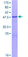 Human Alpha-S1-Casein / CSN1S1 Protein (Recombinant GST)