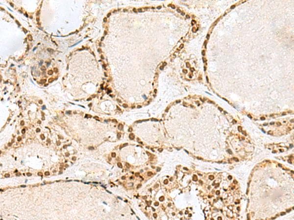 GTF3C2 Antibody