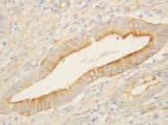 EDNRB / Endothelin B Receptor Antibody (Internal, Sepharose)