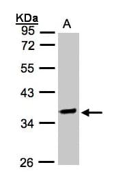 Polyclonal Rabbit anti-Human OSGEP Antibody (aa140-335, IHC, WB)