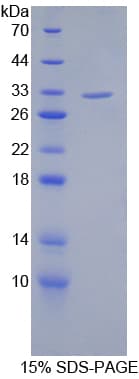 Human SIRT3 / Sirtuin 3 Protein (Recombinant His)
