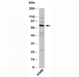 TNFAIP2 Antibody (Internal)