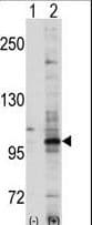 EPHA7 / EPH Receptor A7 Antibody (aa896-925)