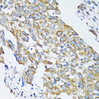 Polyclonal Rabbit anti-Human SLC25A13 / CITRIN Antibody (IHC, IF, WB)