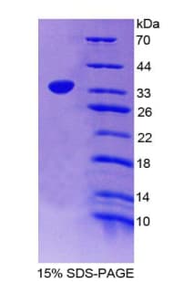 Rat APOH / Apolipoprotein H (Recombinant His-T7)