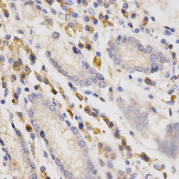 SIAH1 Antibody