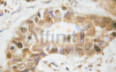 LMNA / Lamin A+C Antibody