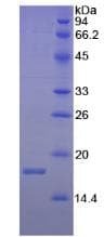 Chicken IFN Gamma / Interferon Gamma Protein (Recombinant His, N-Terminal)