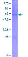 Human DHRS3 / SDR1 Protein (Recombinant GST)