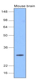 Monoclonal Mouse anti-Human UCHL1 / PGP9.5 Antibody (clone 3D9, aa1-223, IHC, WB)