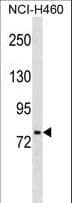 HNF1A / HNF1 Antibody (aa177-205)