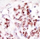 TLK1 Antibody (aa720-750)