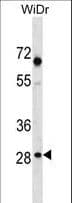 SNX11 Antibody (aa75-104)