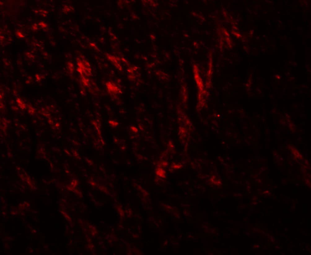 IHC-plus™ TNM / Teneurin-1 Antibody