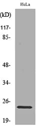 RAB5A / RAB5 Antibody