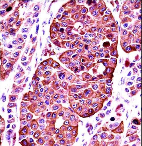 Tyrosinase Antibody (aa176-205)