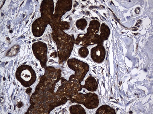 Monoclonal Mouse anti-Human ALDH7A1 Antibody (clone OTI1A9, IHC, WB)