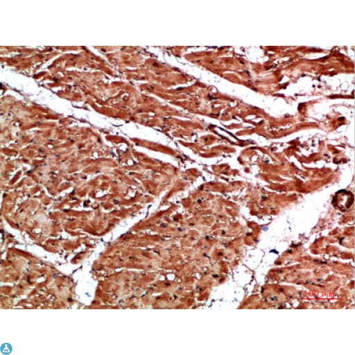 Polyclonal Rabbit anti-Human TTN / Titin Antibody (aa161-210, IHC)