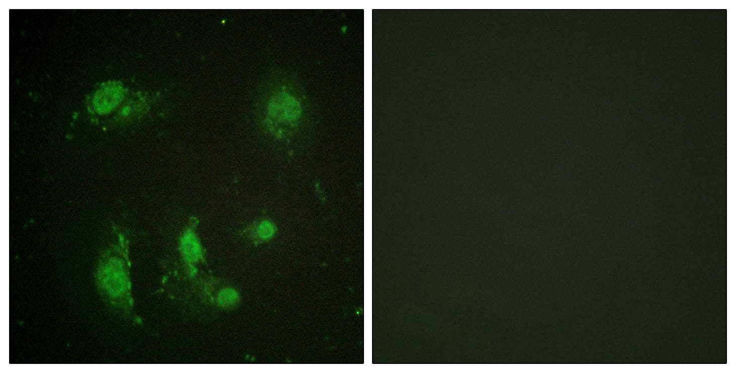 Polyclonal Rabbit anti-Human BIRC5 / Survivin Antibody (p117, IHC, IF, WB)