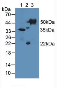 TUBD1 / Tubulin Delta Antibody (aa236-455, APC)