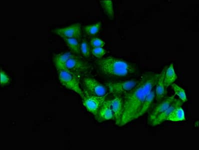 Polyclonal Rabbit anti-Human RUNX3 Antibody (IHC, IF, WB)