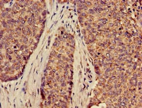 SLC2A9 / GLUT9 Antibody