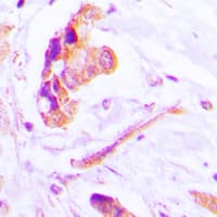 CASP3 / Caspase 3 Antibody (Internal)
