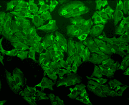IHC-plus™ HIF2A / EPAS1 Antibody (clone EP190b)