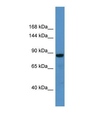 CADPS Antibody (aa542-591)